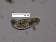 Paramecium