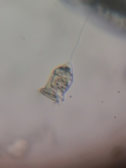 Vorticellidae