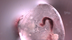 Simocephalus