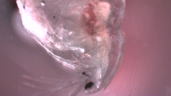 Simocephalus