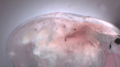 Simocephalus