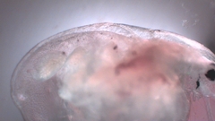 Simocephalus