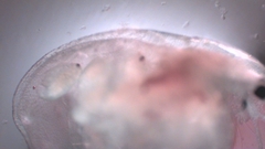Simocephalus