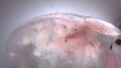 Simocephalus