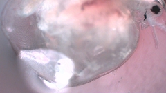 Simocephalus