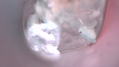 Simocephalus