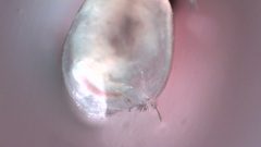 Simocephalus