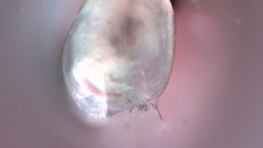 Simocephalus