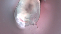 Simocephalus