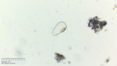 Quadrulella symmetrica