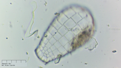 Quadrulella symmetrica