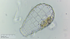 Quadrulella symmetrica