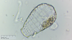 Quadrulella symmetrica