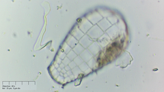 Quadrulella symmetrica