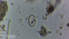 Cocconeis