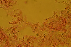 Camarophyllopsis