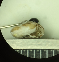 Ventridens suppressus