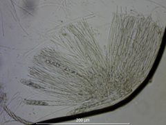 Ascocoryne sarcoides