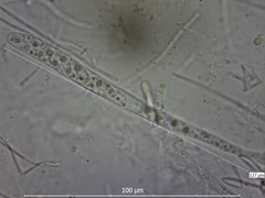 Ascocoryne sarcoides