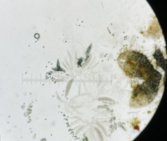 Podospora collapsa