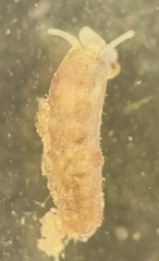 Caecum