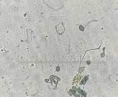 Podospora collapsa