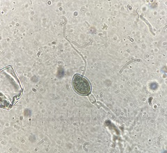 Podospora collapsa