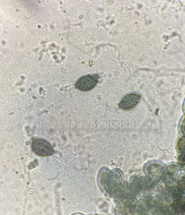 Podospora collapsa
