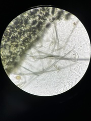 Podospora collapsa