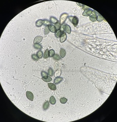 Podospora collapsa