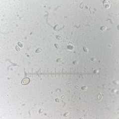 Melanoleuca malenconii