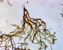 Bacteria