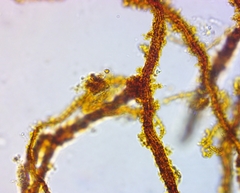 Bacteria