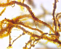 Bacteria