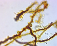 Bacteria