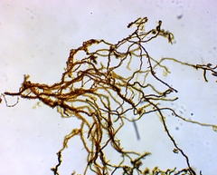 Bacteria