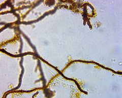 Bacteria