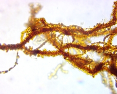 Bacteria