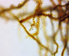 Bacteria