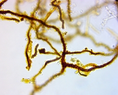 Bacteria
