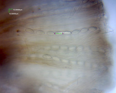 Plectania rhytidia