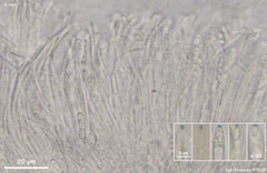 Bisporella subpallida