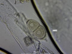 Puccinia glechomatis