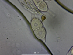 Puccinia glechomatis