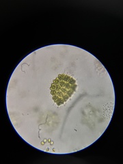 Pseudopediastrum