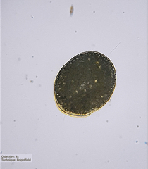 Ophryoglena