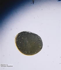 Ophryoglena