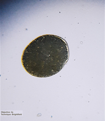 Ophryoglena