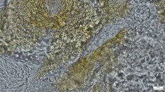 Trichoderma