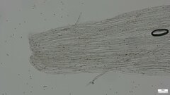 Coprinellus